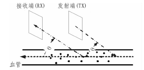 基于多普勒原理的血流速度计设计