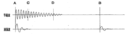t62-1.gif (2717 bytes)