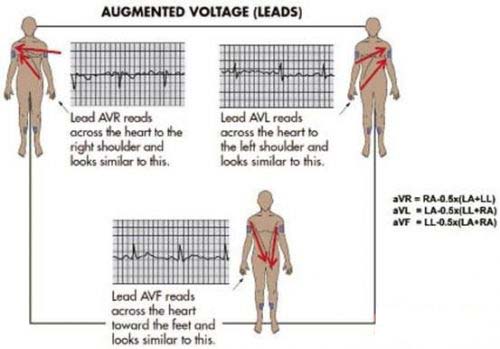 图4 经过心脏的aVx导联测量