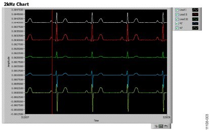 连接病人仿真器的ADAS1000屏幕截图，心率 = 70 BPM