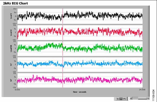使用ADAS1000评估板和评估软件时导联模式下ADAS1000噪声测量的屏幕截图