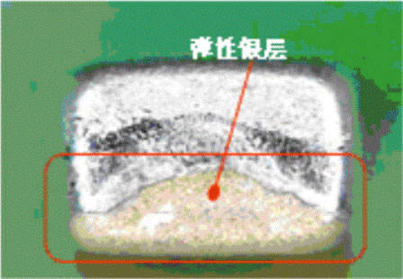 使用柔性端头降低陶瓷贴片电容短路风险